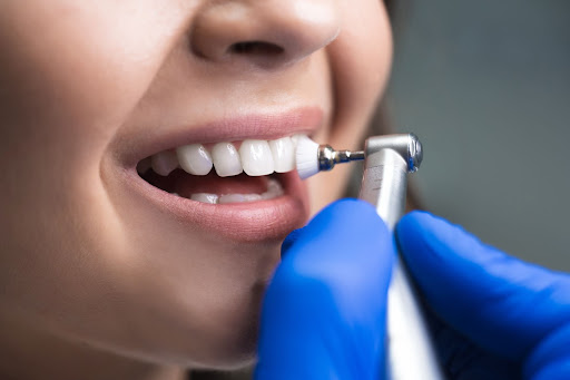 Services San Juan Dentistry, Dental care in Jacksonville Services 6